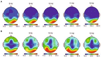 Resting-state frontal, frontlateral, and parietal alpha asymmetry:A pilot study examining relations with depressive disorder type and severity